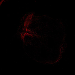 13PCW human midbrain